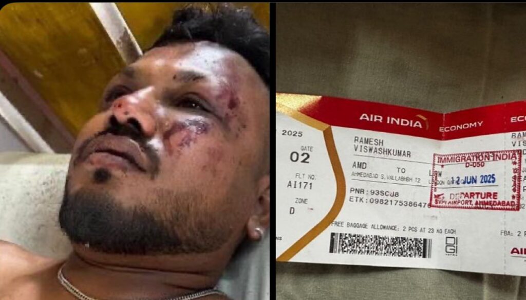 Sole survivor of Air India Dreamliner crash Ahmedabad, Ramesh Viswashkumar